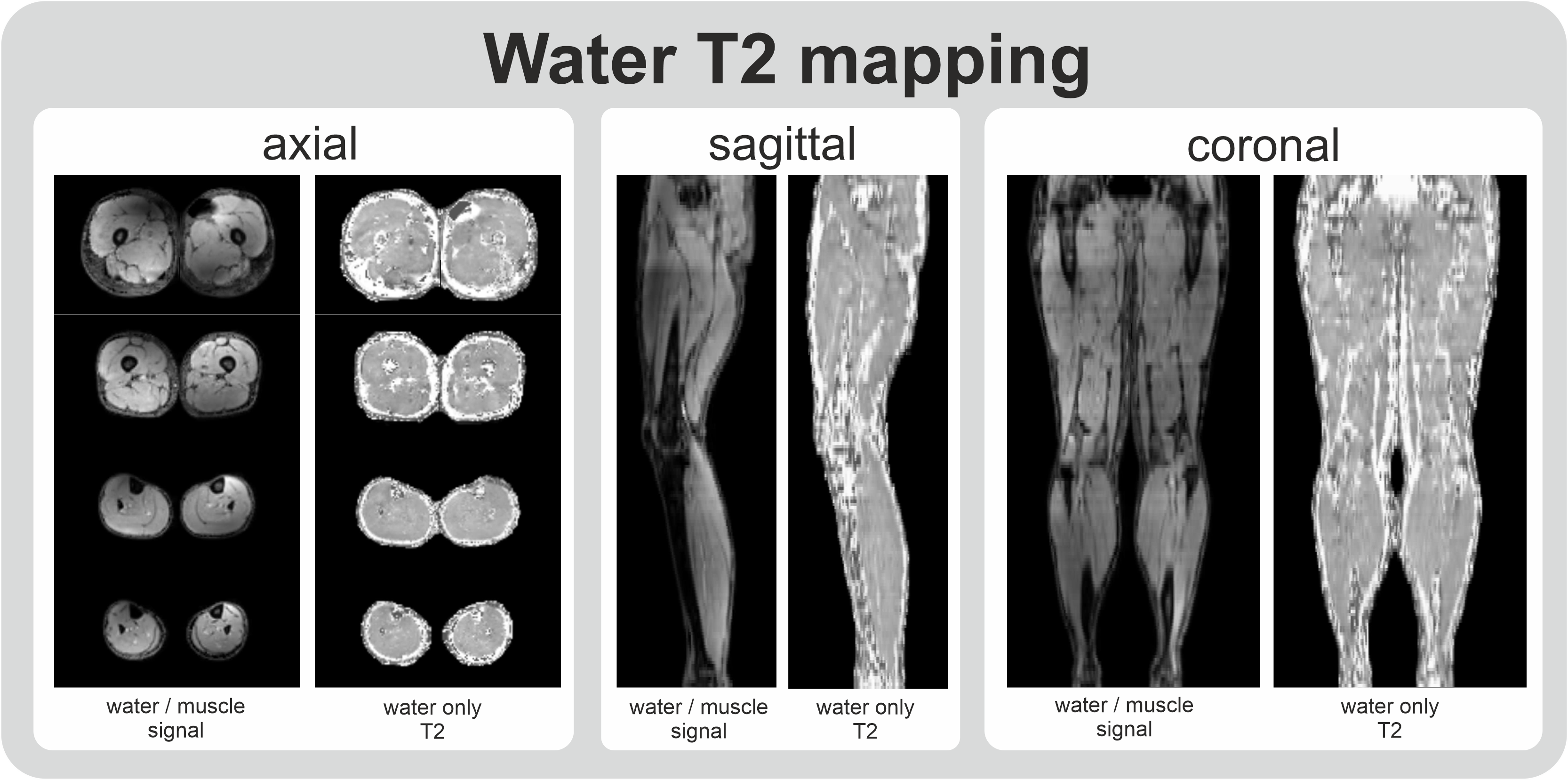 Whole leg water only t2 mapping of muscle