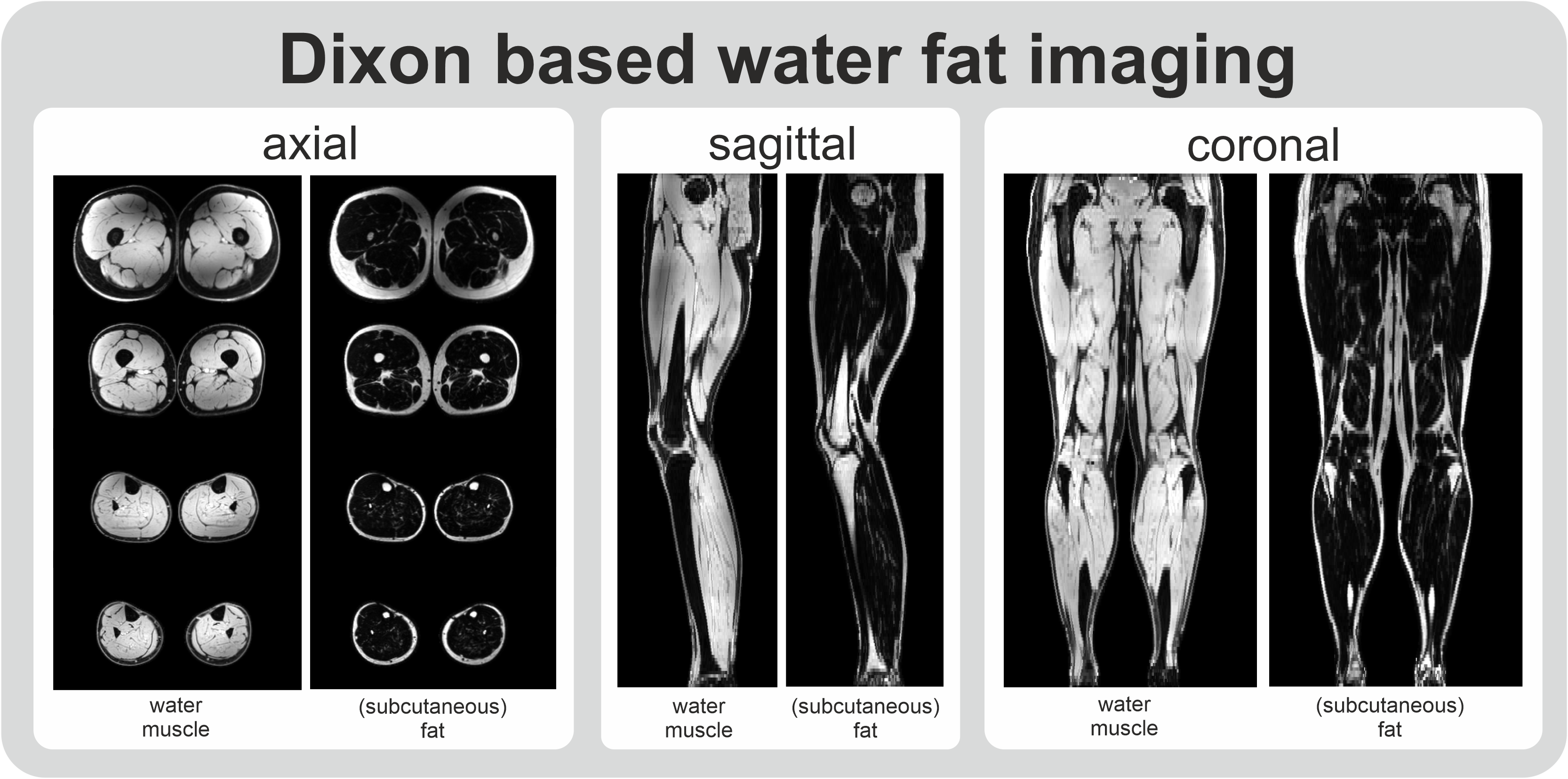 Whole leg Dixon based water fat imaging of muscle