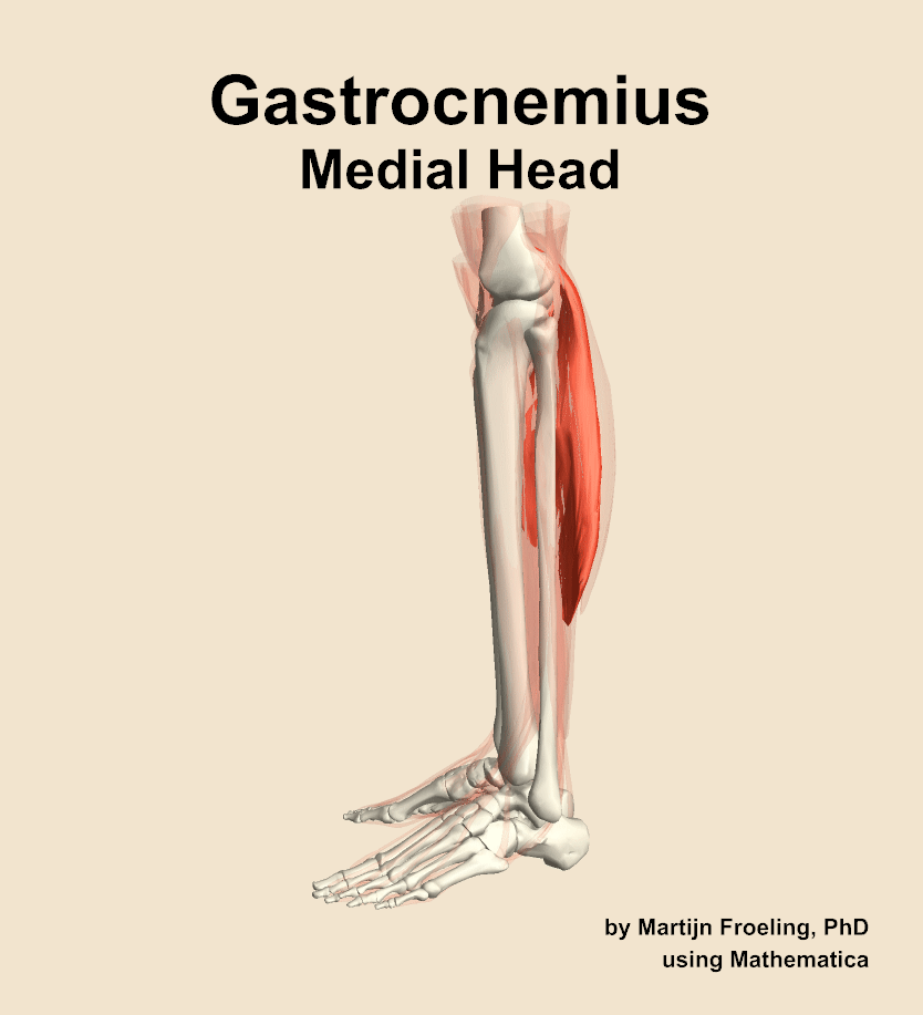 The medial head of the gastrocnemius muscle of the leg