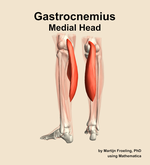 The medial head of the gastrocnemius muscle of the leg - orientation 4