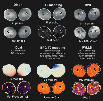 Quantitative muscle MRI processing and analysis