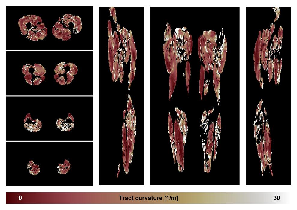 Muscle fiber tract curvature map based on whole leg DTI based fiber tractography.