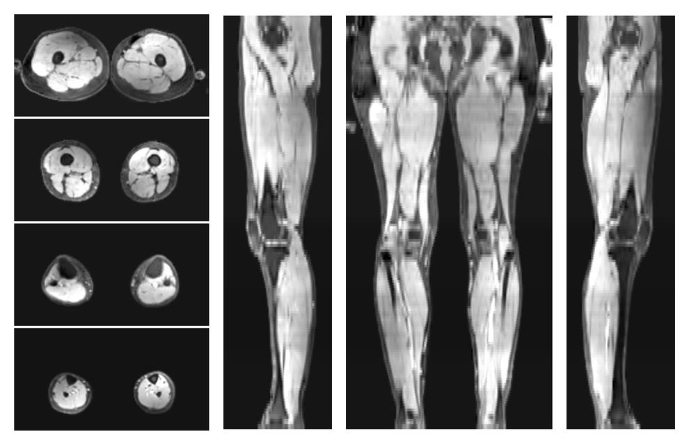 The water part of the acquired multi-echo spin echo data.