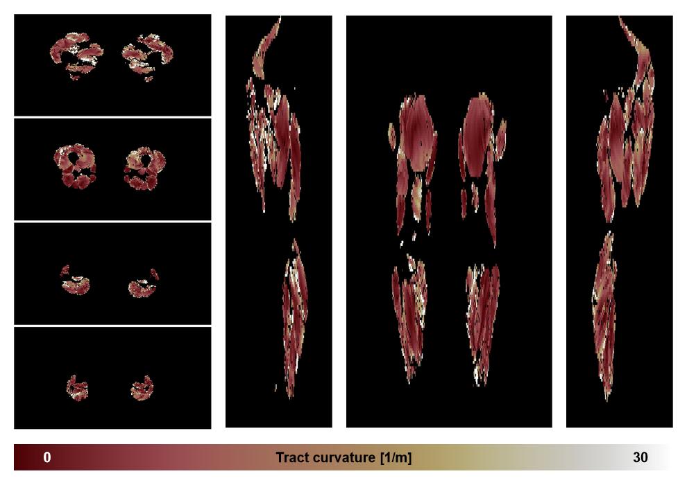 Muscle fiber tract curvature map based on whole leg DTI based fiber tractography.