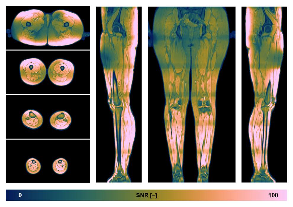 The SNR distribution of the dixon data.