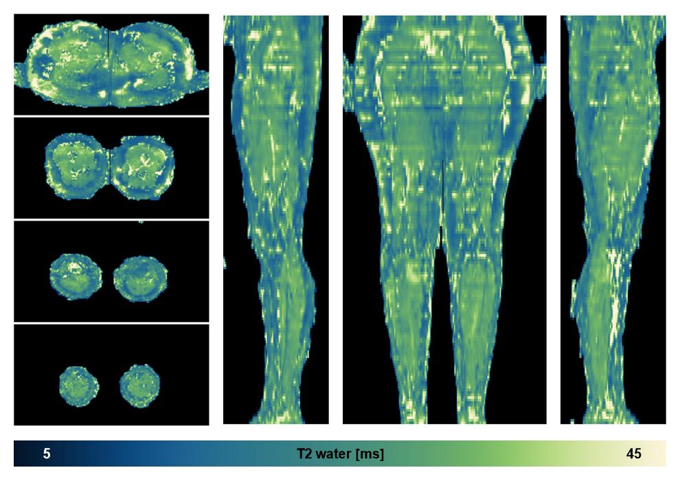 The water only T2 relaxation time of the lower extremity obtained from multi echo spin echo t2 mapping with EPG based reconstruction.