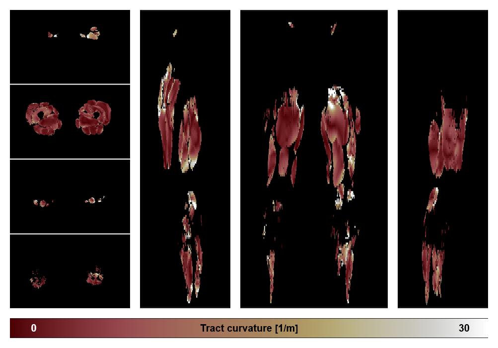 Muscle fiber tract curvature map based on whole leg DTI based fiber tractography.