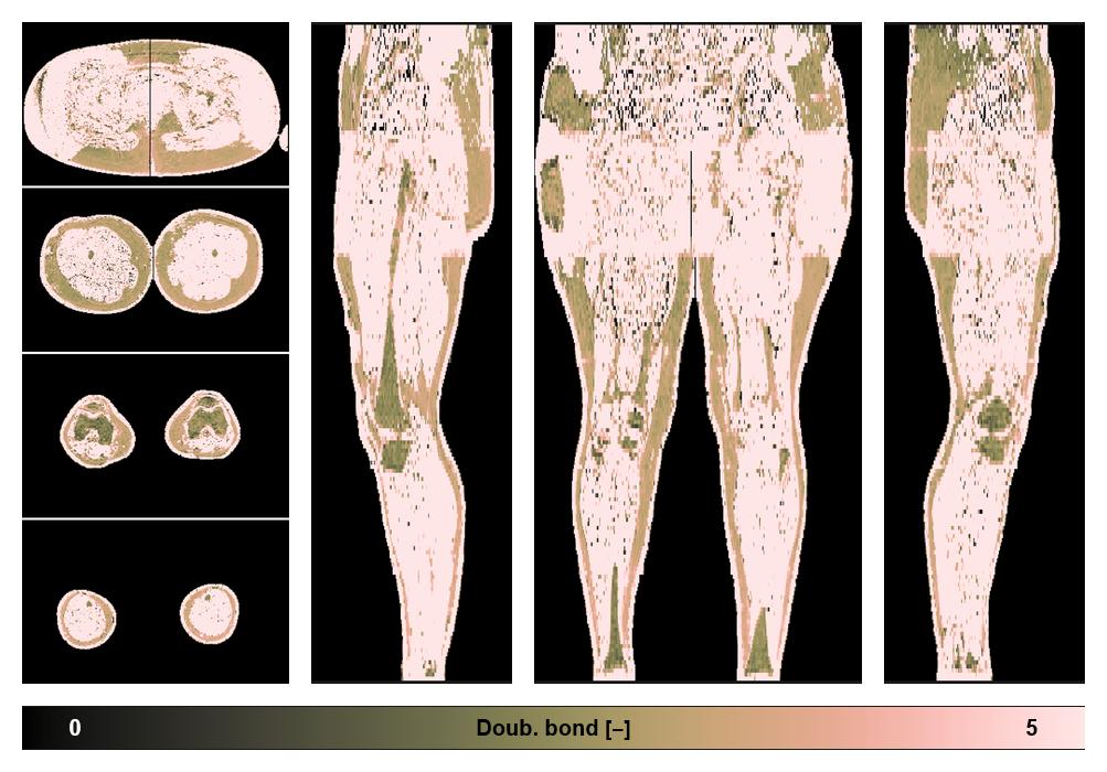 Number of double bonds in subcutanious fat.