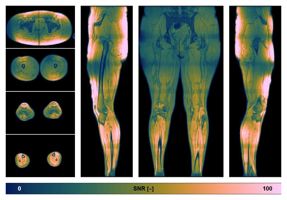 The SNR distribution of the dixon data.