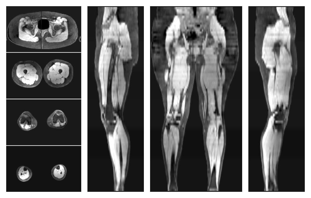 The water part of the acquired multi-echo spin echo data.