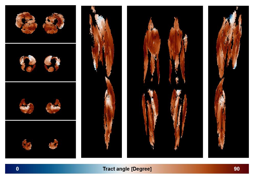 Muscle fiber tract angle map based on whole leg DTI based fiber tractography.