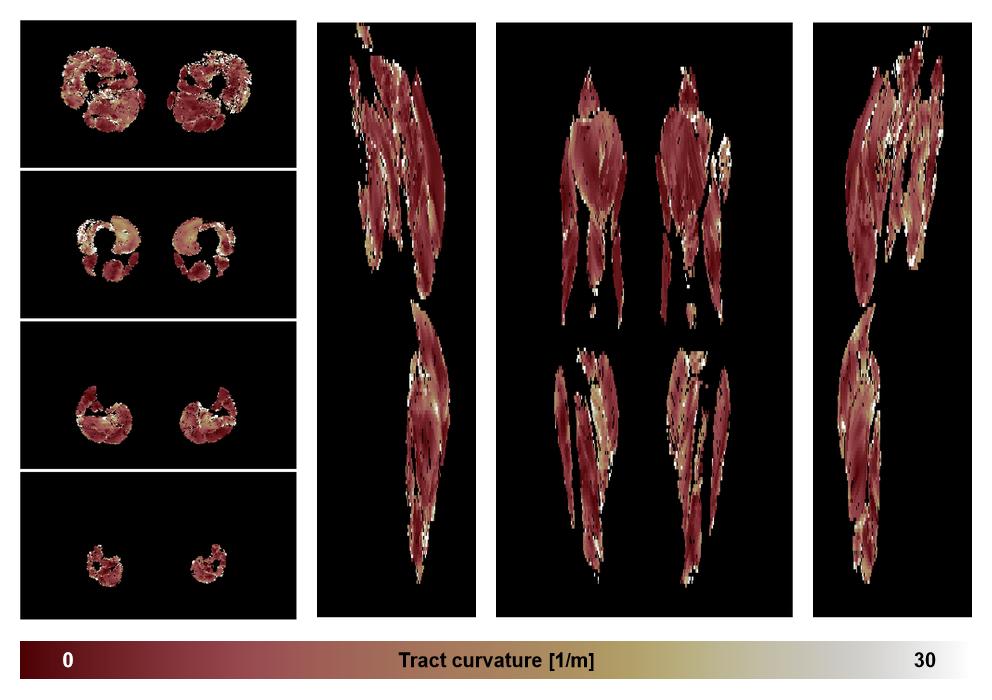 Muscle fiber tract curvature map based on whole leg DTI based fiber tractography.