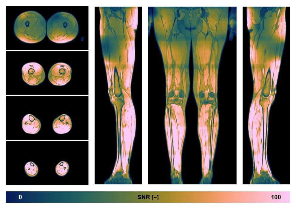 The SNR distribution of the dixon data.