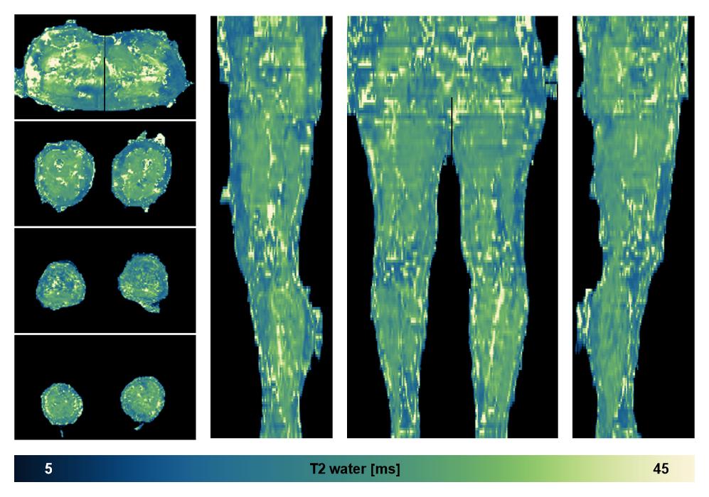 The water only T2 relaxation time of the lower extremity obtained from multi echo spin echo t2 mapping with EPG based reconstruction.