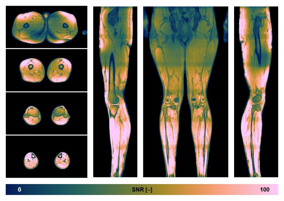 The SNR distribution of the dixon data.
