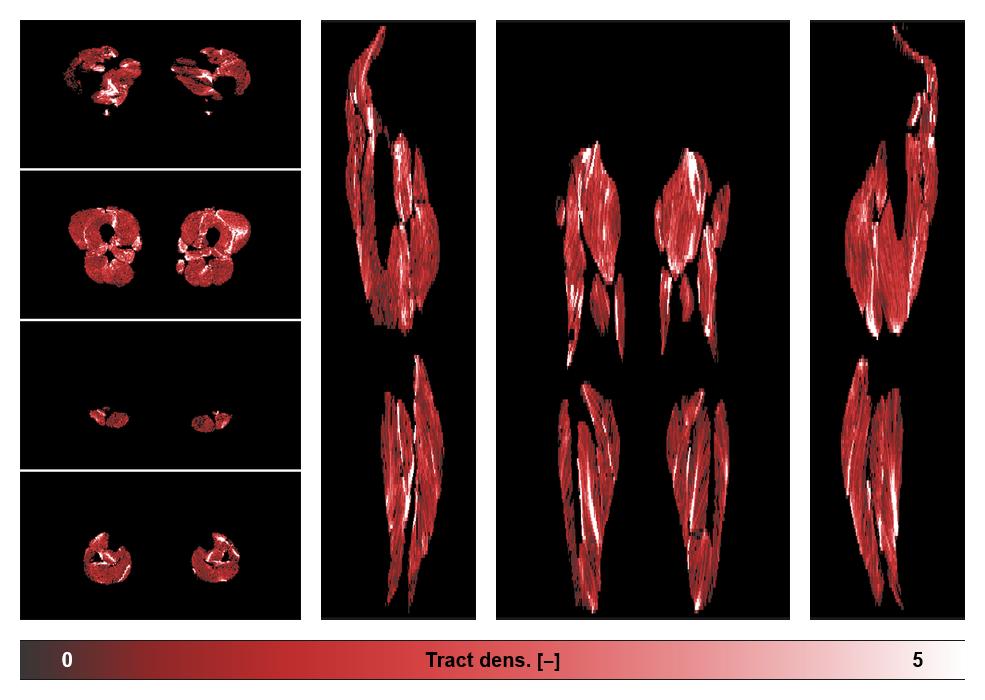 Muscle fiber tract density map based on whole leg DTI based fiber tractography.