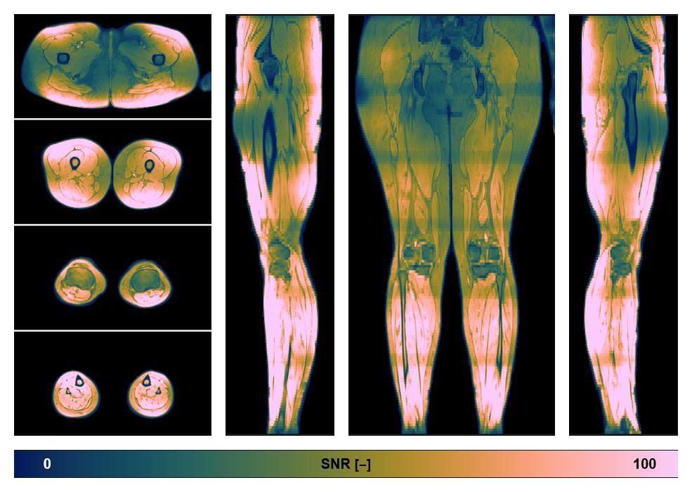 The SNR distribution of the dixon data.