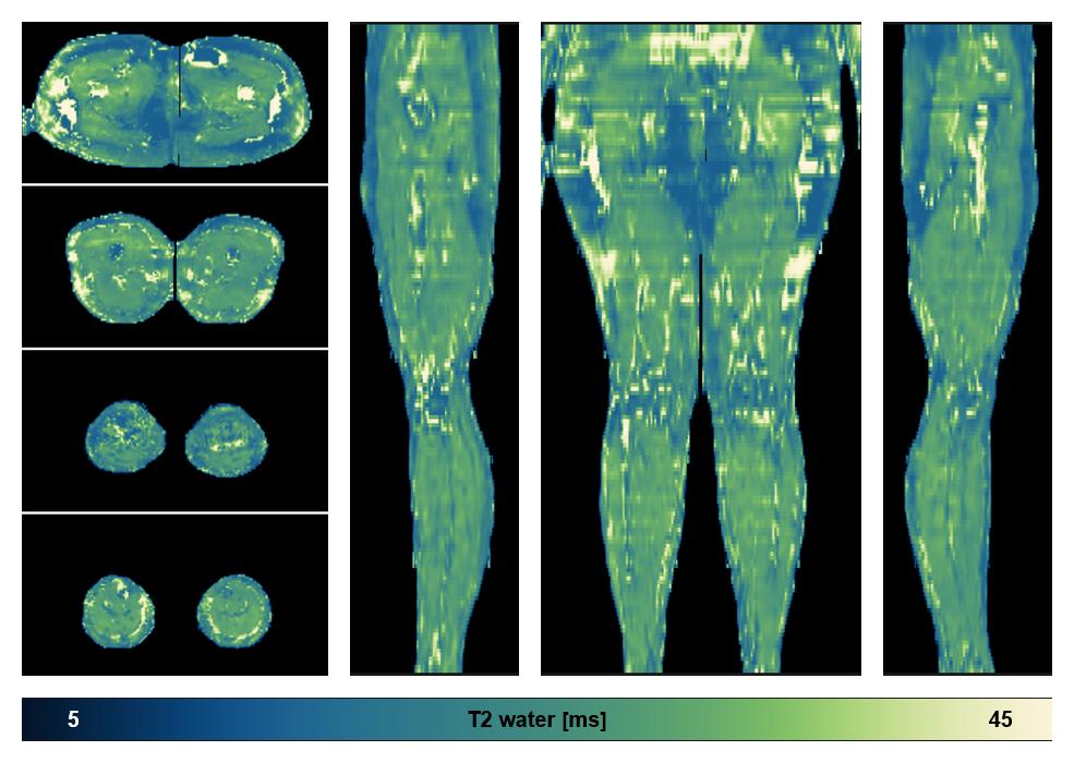 The water only T2 relaxation time of the lower extremity obtained from multi echo spin echo t2 mapping with EPG based reconstruction.