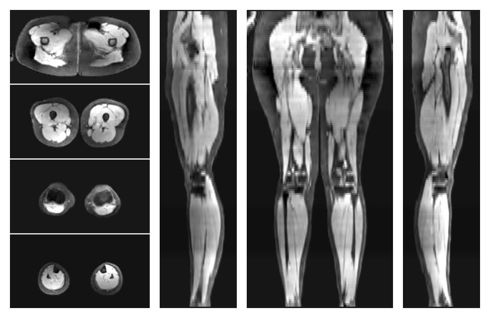 The water part of the acquired multi-echo spin echo data.