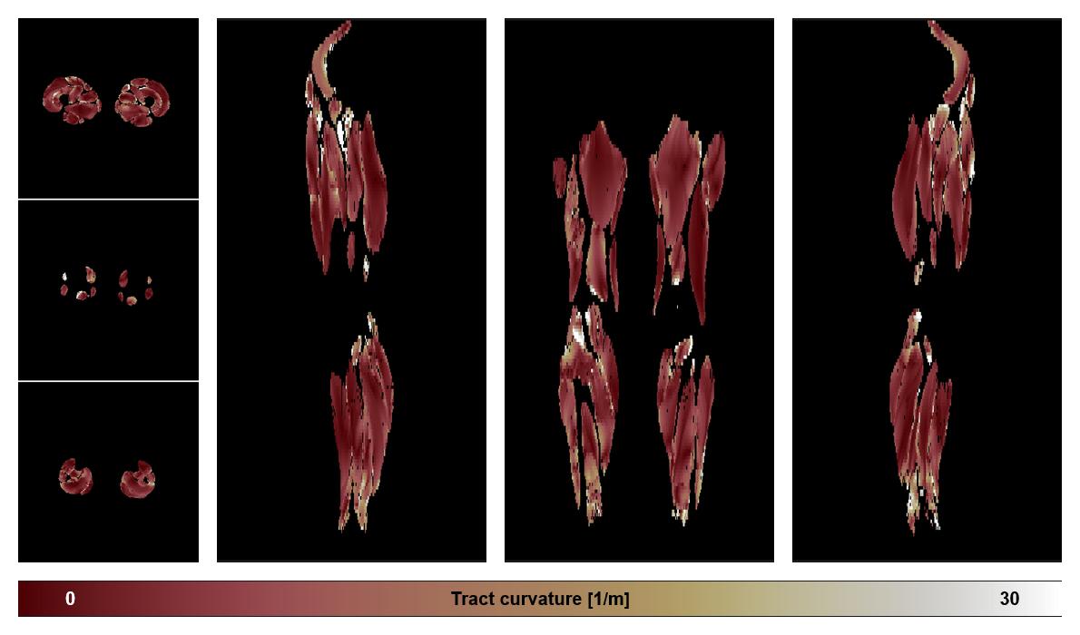 Muscle fiber tract curvature map based on whole leg DTI based fiber tractography.