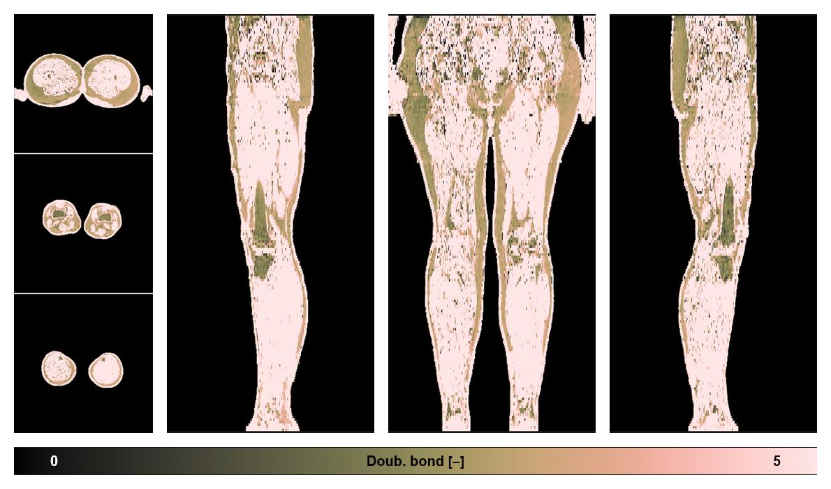 Number of double bonds in subcutanious fat.