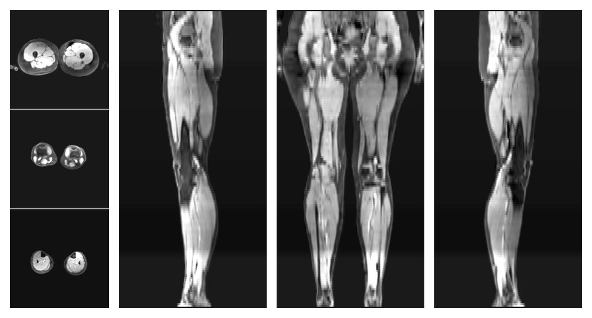 The water part of the acquired multi-echo spin echo data.