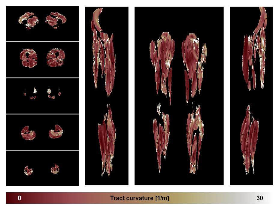Muscle fiber tract curvature map based on whole leg DTI based fiber tractography.