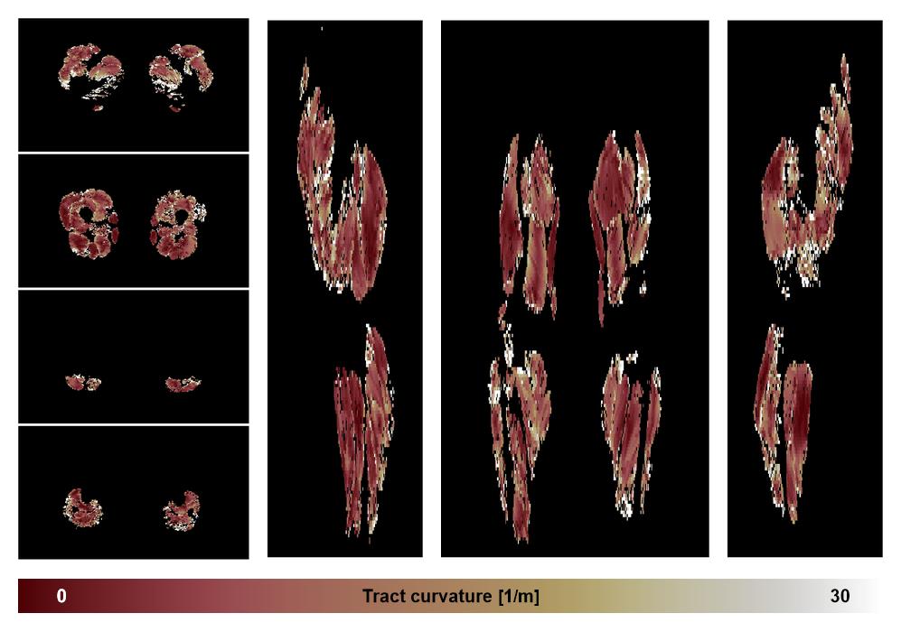Muscle fiber tract curvature map based on whole leg DTI based fiber tractography.