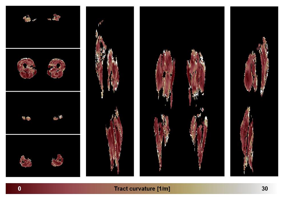 Muscle fiber tract curvature map based on whole leg DTI based fiber tractography.