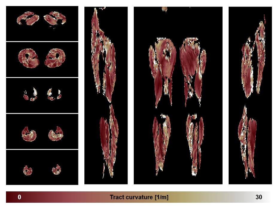 Muscle fiber tract curvature map based on whole leg DTI based fiber tractography.