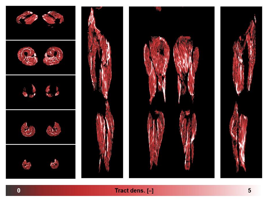 Muscle fiber tract density map based on whole leg DTI based fiber tractography.