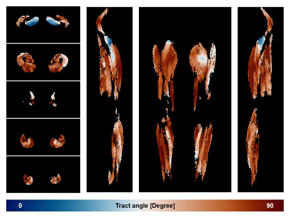 Muscle fiber tract angle map based on whole leg DTI based fiber tractography.