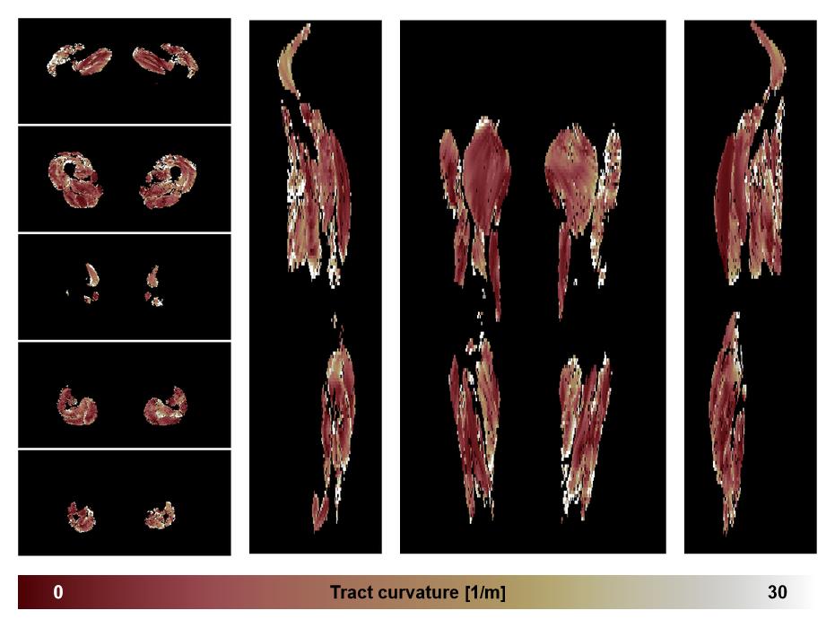 Muscle fiber tract curvature map based on whole leg DTI based fiber tractography.
