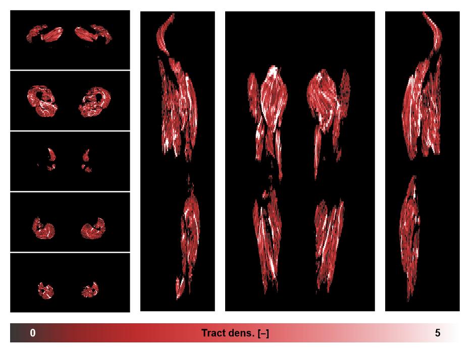 Muscle fiber tract density map based on whole leg DTI based fiber tractography.