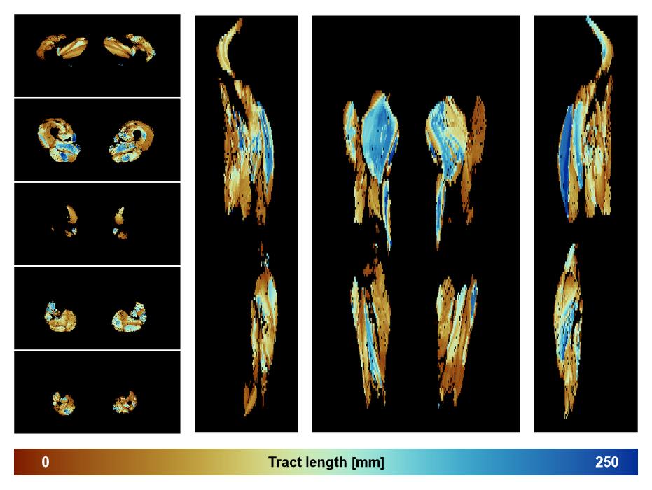 Muscle fiber tract length map based on whole leg DTI based fiber tractography.