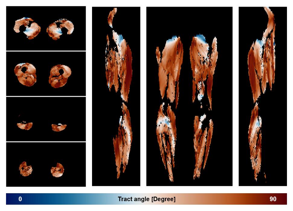 Muscle fiber tract angle map based on whole leg DTI based fiber tractography.