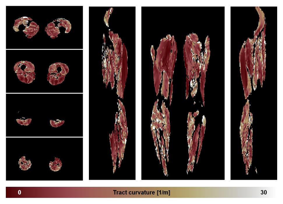 Muscle fiber tract curvature map based on whole leg DTI based fiber tractography.