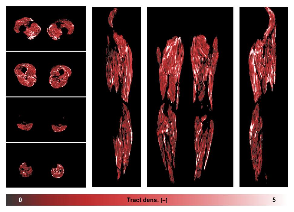 Muscle fiber tract density map based on whole leg DTI based fiber tractography.