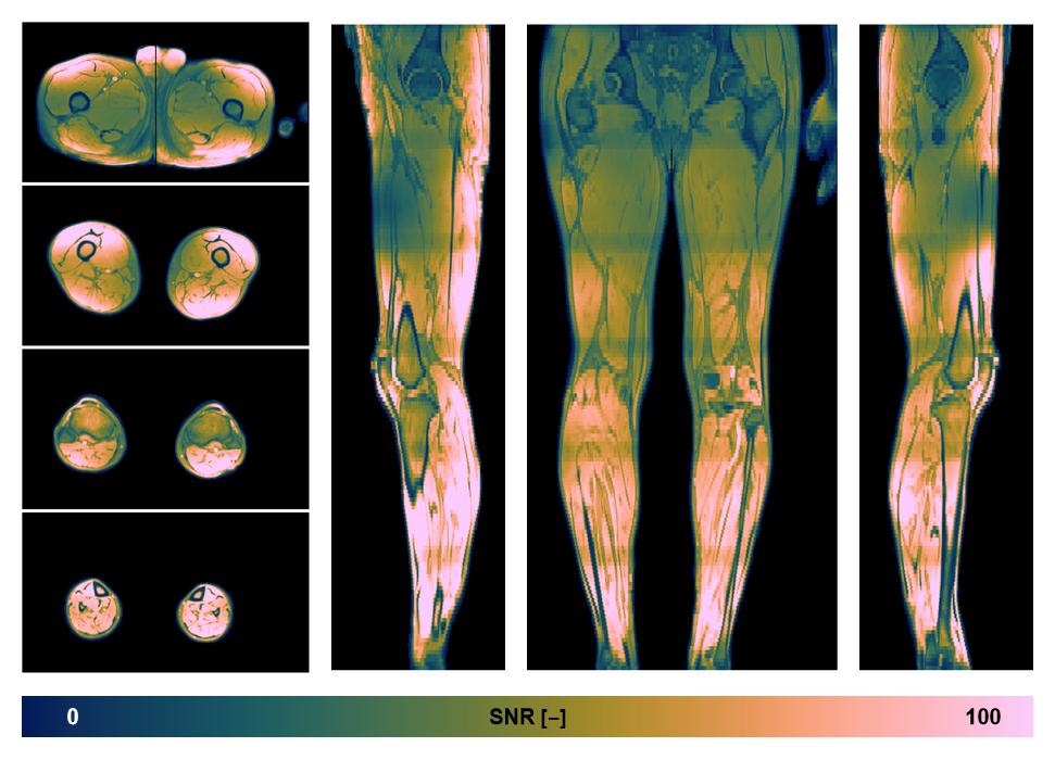 The SNR distribution of the dixon data.