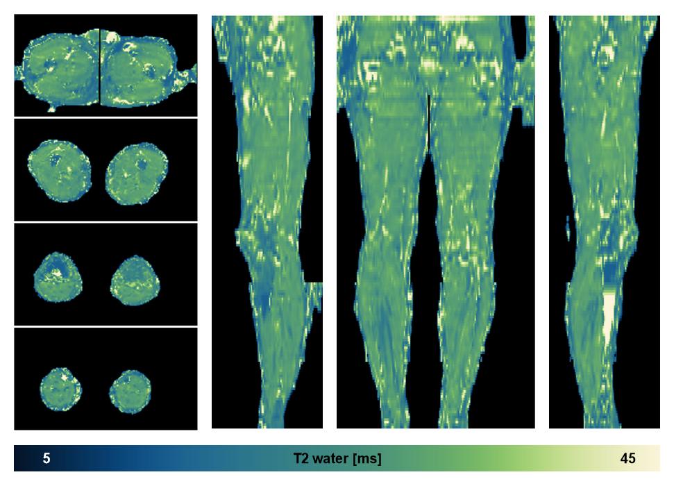 The water only T2 relaxation time of the lower extremity obtained from multi echo spin echo t2 mapping with EPG based reconstruction.