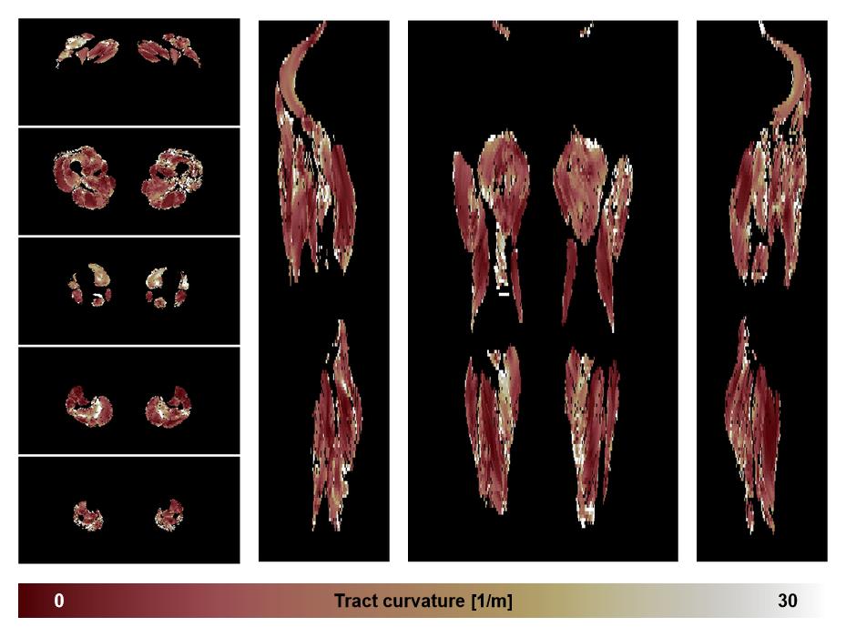 Muscle fiber tract curvature map based on whole leg DTI based fiber tractography.