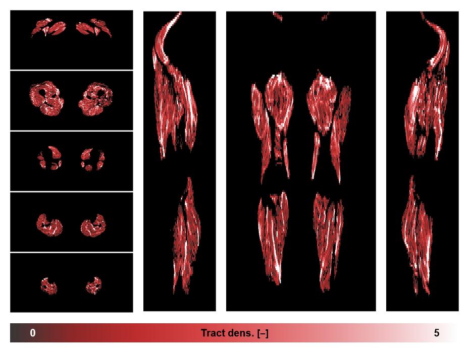 Muscle fiber tract density map based on whole leg DTI based fiber tractography.