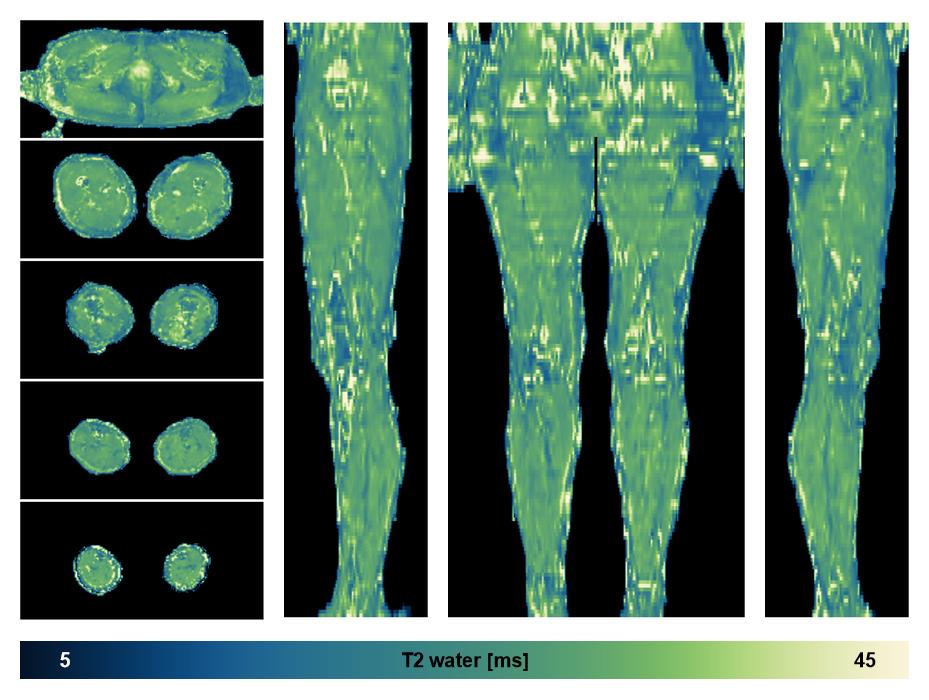 The water only T2 relaxation time of the lower extremity obtained from multi echo spin echo t2 mapping with EPG based reconstruction.