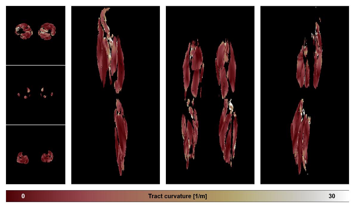 Muscle fiber tract curvature map based on whole leg DTI based fiber tractography.