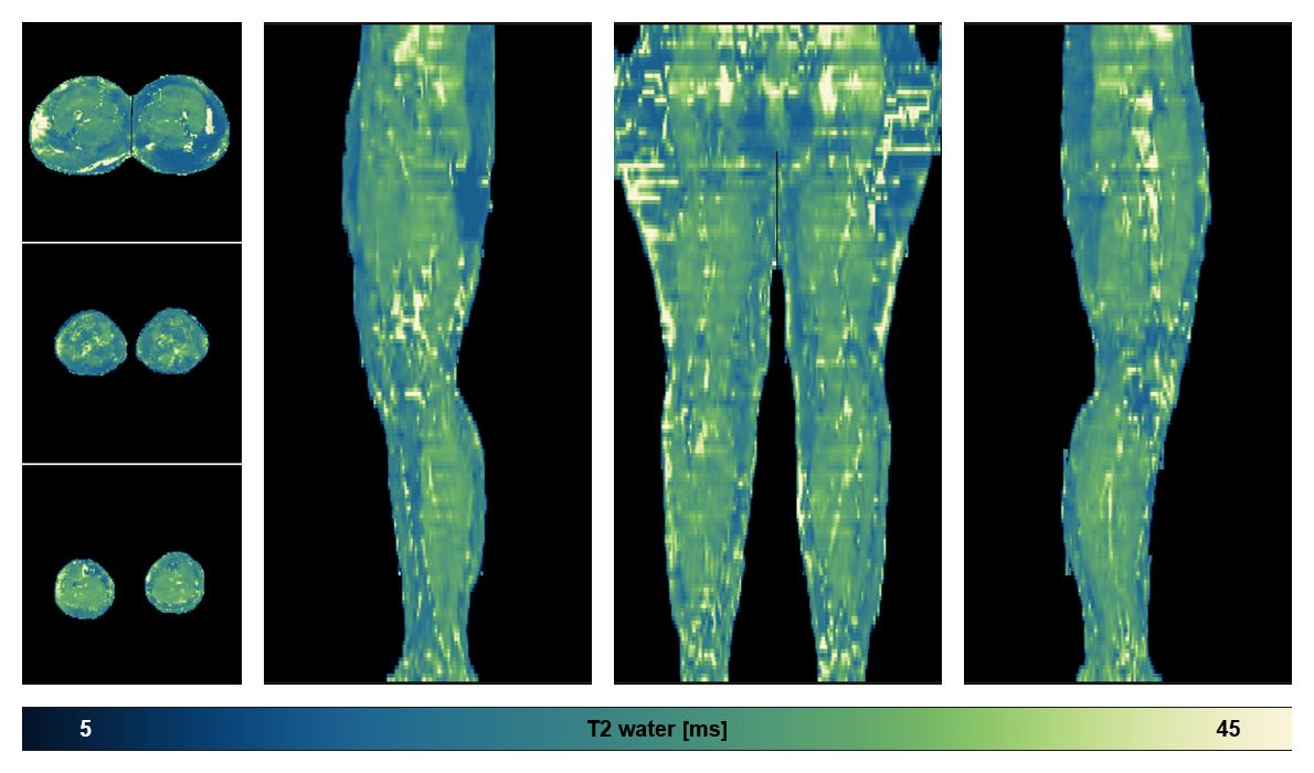 The water only T2 relaxation time of the lower extremity obtained from multi echo spin echo t2 mapping with EPG based reconstruction.