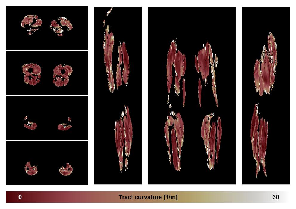 Muscle fiber tract curvature map based on whole leg DTI based fiber tractography.