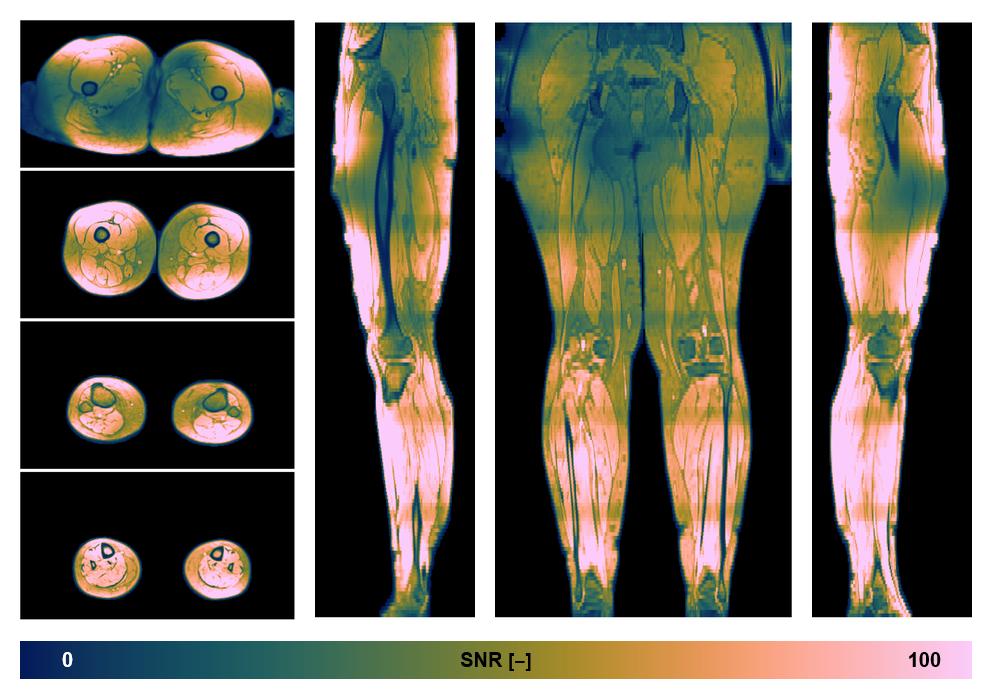 The SNR distribution of the dixon data.