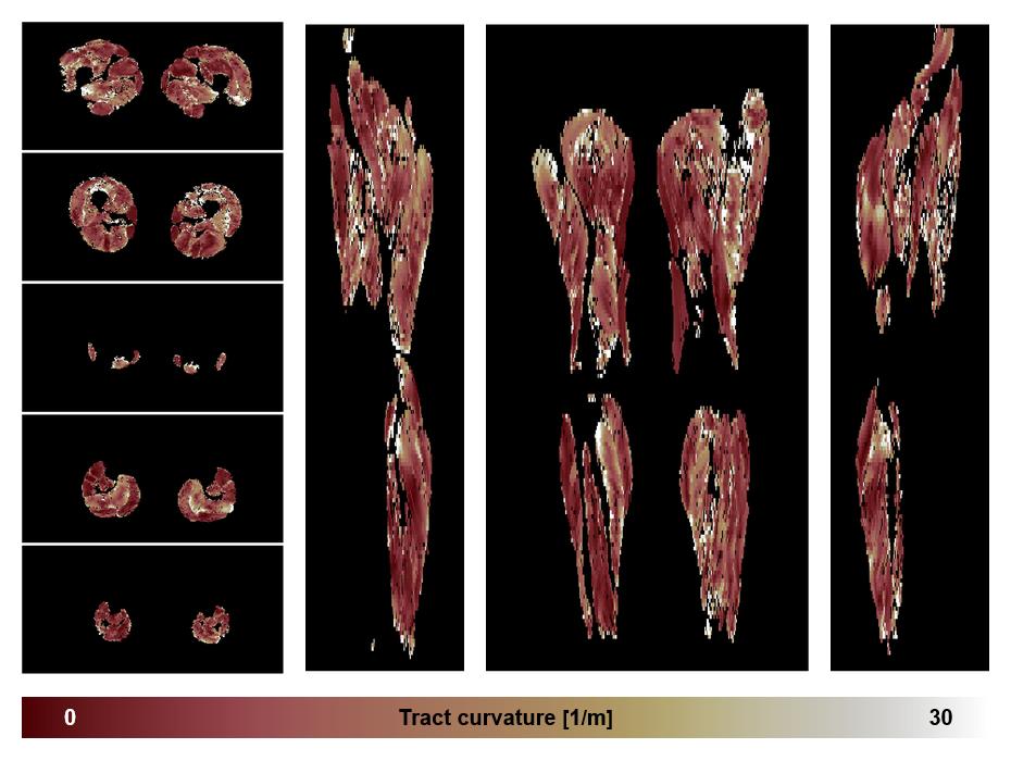 Muscle fiber tract curvature map based on whole leg DTI based fiber tractography.