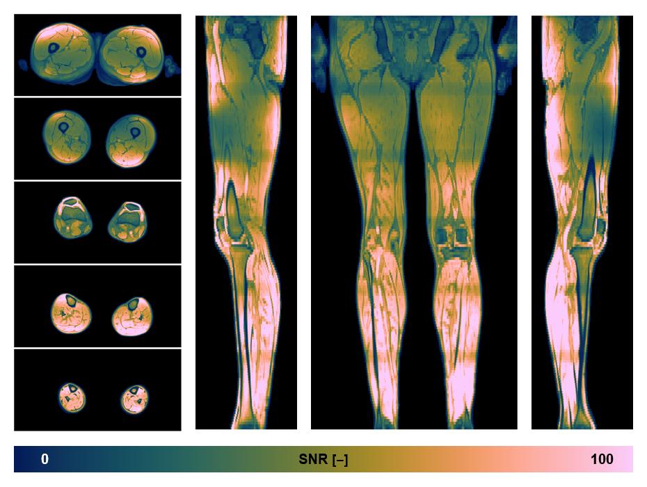 The SNR distribution of the dixon data.