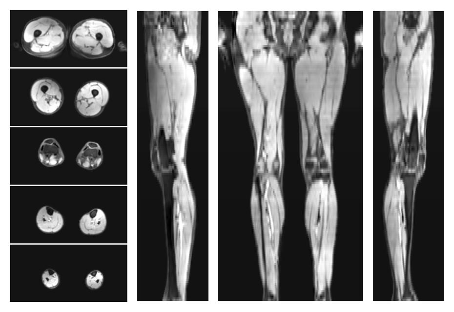 The water part of the acquired multi-echo spin echo data.